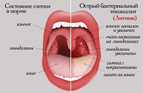 У каждого заболевания есть свои признаки, свои симптомы