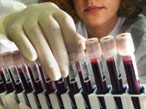 Маленькие эритроциты, также известные как эритроциты, имеют особое значение для процессов, происходящих в организме, поскольку их основная функция заключается в переносе кислорода из легких в ткани